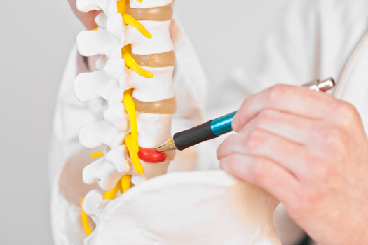 10.13 - How to Fix a Reherniation - Barricaid