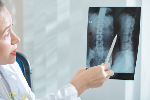 10.8 - How Do I Know if I Have Sciatica or a Herniated Disc - Barricaid