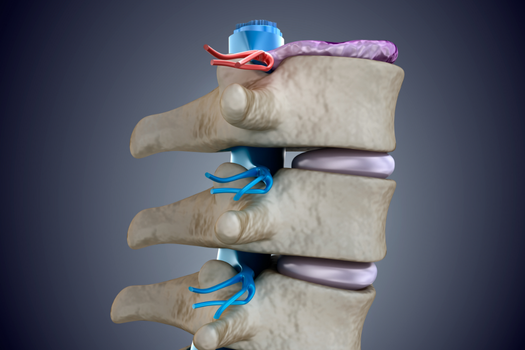 11.12 - What Is the Difference between a Herniated Disc and a Disc Extrusion