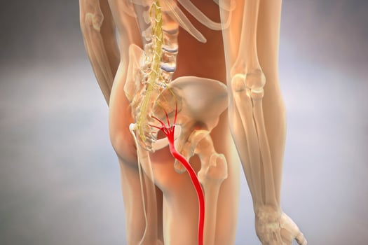 5.24 - How-Do-You-Know-When-Sciatica-Is-Getting-Worse-1