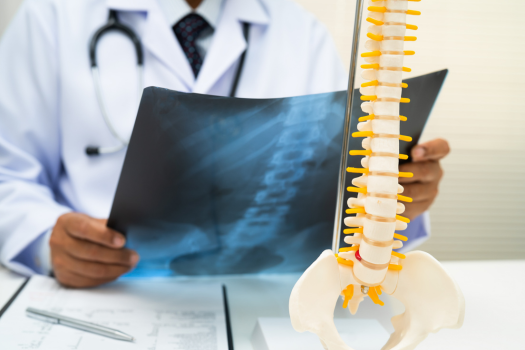 6.15 - Exploring the Anatomy of a Discectomy_ What Actually Happens to Your Herniated Disc Barricaid USA