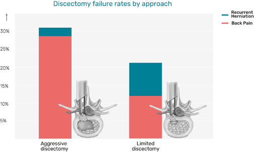 A published meta-analysis shows discectomy failure rates by approach_Barricaid