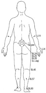 How to Manage Leg Pain Leading Up to Your Discectomy_Acupuncture Diagram