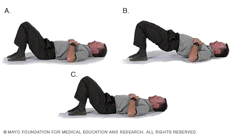 How to Manage Leg Pain Leading Up to Your Discectomy_Bridge exercise_Barricaid