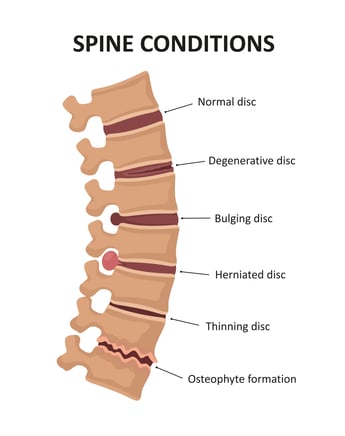Spine Illustration