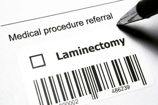 Can You Do a Discectomy without a Laminectomy