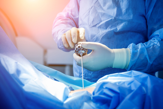 How to Tell if Discectomy Surgery Has Failed