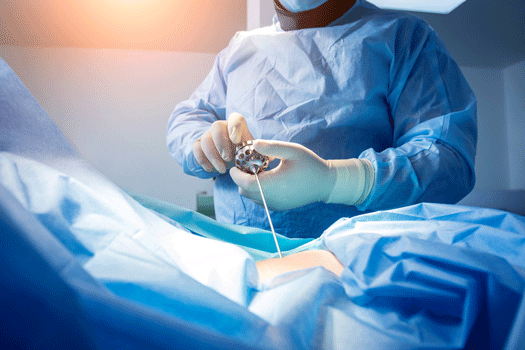 How Long Is Microdiscectomy Surgery?