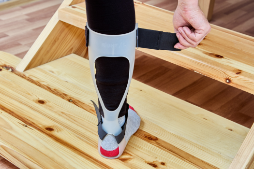 Will Microdiscectomy Help Foot Drop?