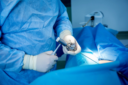 Do You Need a Laminectomy with Microdiscectomy Surgery?